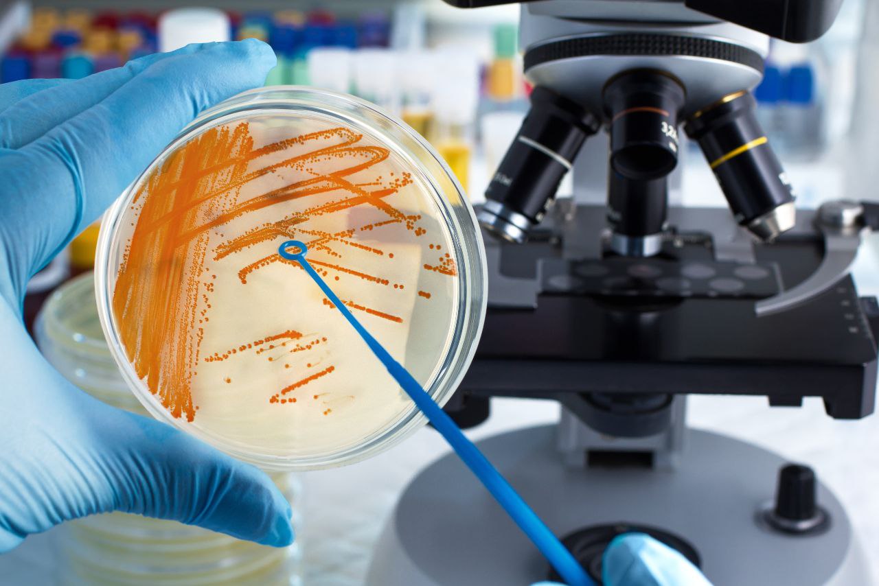 Máster Universitario en Investigación y Avances en Microbiología